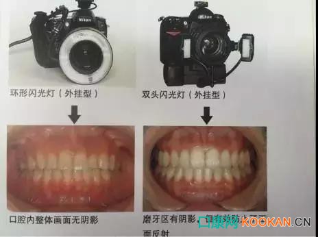 拍不好口腔照片怎么辦？這些口腔攝影方法與技巧請(qǐng)收好！